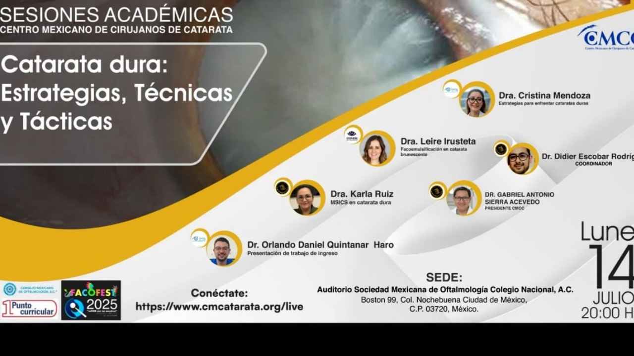 Catarata dura: Estrategias, Técnicas y Tácticas